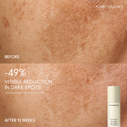 Hyper Real Serumizer™ Skin Balancing Hydration Serum